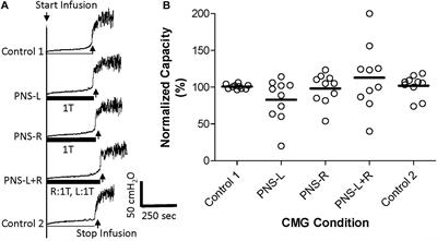 Additive Inhibition of Reflex Bladder Activity Induced by Bilateral Pudendal Neuromodulation in Cats